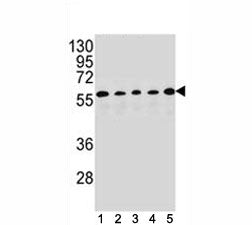 PAX1 antibody western blot analysis in (1) HepG2, (2) MDA-MB453, (3) 293, (4) K562 and (5) MCF-7 lysate. Predicted size 45~55 kDa