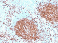 IHC staining of FFPE human tonsil with recombinant PAX5 antibody. HIER: boil tissue sections in pH 9 10mM Tris with 1mM EDTA for 20 min and allow to cool before testing.