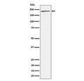 Western blot testing of human 293T cell lysate with MEKK4 antibody. Predicted molecular weight: 177-182 kDa (two isoforms).