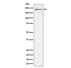 Western blot testing of human 293T cell lysate with MEKK4 antibody. Predicted molecular weight: 177-182 kDa (two isoforms).