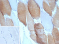 IHC staining of FFPE human skeletal muscle tissue with Myosin 7 antibody (clone MYH7/9184). Inset: PBS used in place of primary Ab (secondary Ab negative control). HIER: boil tissue sections in pH 9 10mM Tris with 1mM EDTA for 20 min and allow to cool before testing.
