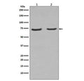 Western blot testing of rat 1) C6 and 2) PC-12 cell lysate with p75NTR antibody. Expected molecular weight: 45-75 kDa depending on glycosylation level.
