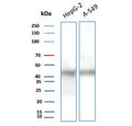 Western blot testing of human 1) HepG2 and 2) A549 cell lysate with Gamma Enolase antibody (clone ENO2/9046). Predicted molecular weight ~47 kDa.