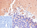 IHC staining of FFPE human brain tissue with CD135 antibody (clone FLT3/9889). Inset: PBS used in place of primary Ab (secondary Ab negative control). HIER: boil tissue sections in pH 9 10mM Tris with 1mM EDTA for 20 min and allow to cool before testing.