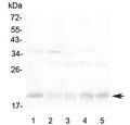 Western blot testing of 1) human Jurkat, 2) rat spleen, 3) rat thymus, 4) mouse spleen and 5) mouse thymus lysate with BAFF Receptor antibody at 0.5ug/ml. Predicted molecular weight ~19 kDa