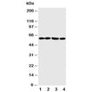 Western blot testing of ANGPTL1 antibody and Lane 1: A549; 2: SW620; 3: MCF-7; 4: MM231 cell lysate