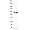 Western blot testing of Alkaline Phosphatase antibody and Lane 1: rat heart; 2: rat brain. Predicted molecular weight ~57 kDa, but can be observed at up to ~75 kDa due to glycosylation.