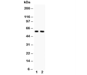 Western blot testing of Alkaline Phosphatase antibody and Lane 1: rat heart; 2: rat brain. Predicted molecular weight ~57 kDa, but can be observed at up to ~75 kDa due to glycosylation.
