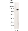 Western blot testing of HEK293 lysate overexpressing human ABCD1 and probed with ABCD1 antibody at 1ug/ml (mock transfection in lane 1). The predicted molecular weight is ~83kDa which is observed in transfected lysate but human brain lysate shows a 50kDa band.
