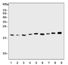 Western blot testing of rat 1) spleen, 2) brain, 3) thymus, 4) kidney and mouse 5) spleen, 6) kidney, 7) RAW264.7 and 8) NIH 3T3 cell lysate with Il1ra antibody. Predicted molecular weight ~20 kDa.