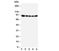Western blot testing of OSBP antibody and Lane 1: rat kidney; 2: (r) spleen; 3: (r) lung; 4: human HeLa; 5: (h) A549 cell lysate