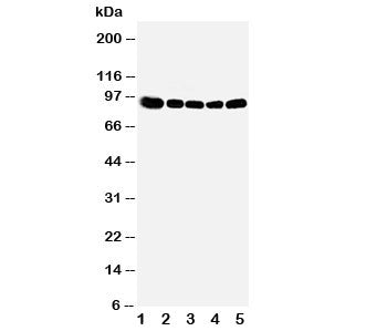 Western blot testing of OSBP antibody and Lane 1: rat kidney; 2: (r) spleen; 3: (r) lung; 4: human HeLa; 5: (h) A549 cell lysate