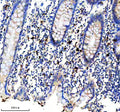 Immunohistochemical staining of CD163b/CD163L1 using anti-CD163L1 antibody. CD163L1 was detected in a paraffin-embedded section of human appendix tissue. Heat mediated antigen retrieval was performed in EDTA buffer (pH 8.0, epitope retrieval solution). The tissue section was blocked with 10% goat serum. The tissue section was then incubated with a dilution of 1:50 rabbit anti-CD163L1 antibody overnight at 4oC. Peroxidase Conjugated Goat Anti-rabbit IgG was used as secondary antibody and incubated for 30 min