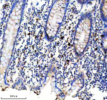 Immunohistochemical staining of CD163b/CD163L1 using anti-CD163L1 antibody. CD163L1 was detected in a paraffin-embedded section of human appendix tissue. Heat mediated antigen retrieval was performed in EDTA buffer (pH 8.0, epitope retrieval solution). The tissue section was blocked with 10% goat serum. The tissue section was then incubated with a dilution of 1:50 rabbit anti-CD163L1 antibody overnight at 4oC. Peroxidase Conjugated Goat Anti-rabbit IgG was used as secondary antibody and incubated for 30 min