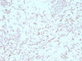 IHC staining of FFPE human liver with Kindlin-1 antibody (clone 4A5.14). HIER: boil tissue sections in pH 9 10mM Tris with 1mM EDTA for 20 min and allow to cool before testing.