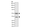 Western blot testing of human HeLa cell lysate with BAG family molecular chaperone regulator 1 antibody. Predicted molecular weight ~50 kDa (long form), 29-33 (short form).