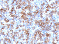 IHC testing of FFPE human tonsil with recombinant CD8 antibody (clone CDLA8a-2R). Required HIER: boil tissue sections in 10mM citrate buffer, pH 6, for 10-20 min followed by cooling at RT for 20 min.