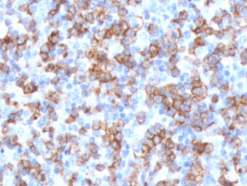IHC testing of FFPE human tonsil with recombinant CD8 antibody (clone CDLA8a-2R). Required HIER: boil tissue sections in 10mM citrate buffer, pH 6, for 10-20 min followed by cooling at RT for 20 min.