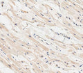 IHC staining of FFPE human heart tissue with MARCH5 antibody. HIER: steam section in pH6 citrate buffer for 20 min and allow to cool prior to staining.