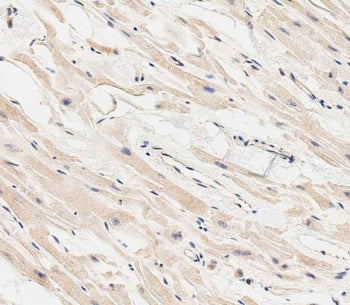 IHC staining of FFPE human heart tissue with MARCH5 antibody. HIER: steam section in pH6 citrate buffer for 20 min and allow to cool prior to staining.