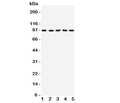 Western blot testing of TRKC antibody on Lane 1: rat brain; 2: mouse brain; 3: human U87; 4: (h) SHG-44; 5: (m) Neuro-2a cell lysate. Observed molecular weight 95~145 kDa depending on glycosylation level.