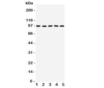 Western blot testing of TRKC antibody on Lane 1: rat brain; 2: mouse brain; 3: human U87; 4: (h) SHG-44; 5: (m) Neuro-2a cell lysate. Observed molecular weight 95~145 kDa depending on glycosylation level.
