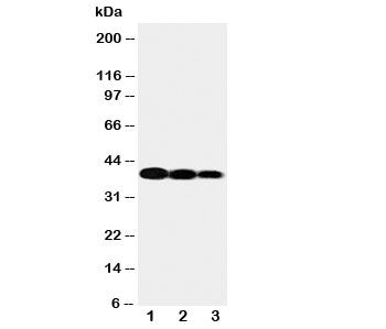 Western blot testing of IL12 p40 antibody and Lane 1: recombinant human protein 10ng; 2: 5ng; 3: 2.5ng