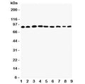 Western blot testing of Plakophilin 2 antibody and Lane 1: rat heart; 2: human placenta; 3: (r) brain; 4: (r) intestine; 5: (h) HeLa; 6: (h) Jurkat; 7: (h) 293T; 8: (h) MCF-7; 9: (h) U87 lysate. Predicted molecular weight: 93-97 kDa.