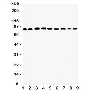 Western blot testing of Plakophilin 2 antibody and Lane 1: rat heart; 2: human placenta; 3: (r) brain; 4: (r) intestine; 5: (h) HeLa; 6: (h) Jurkat; 7: (h) 293T; 8: (h) MCF-7; 9: (h) U87 lysate. Predicted molecular weight: 93-97 kDa.