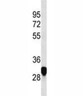PLP antibody western blot analysis in HeLa lysate. Predicted molecular weight ~30/26 kDa (isoforms 1/2).