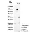 SDS-PAGE analysis of purified, BSA-free GnRH-Receptor antibody (clone A9E4) as confirmation of integrity and purity.