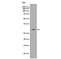Western blot testing of human HeLa cell lysate with CDK1 antibody. Predicted molecular weight ~33 kDa.