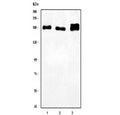 Western blot testing of 1) human HEL, 2) human K562 and 3) rat brain lysate with LARG antibody. Predicted molecular weight ~173 kDa but commonly observed at up to 220 kDa, possibly due to phosphorylation.