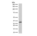 Western blot testing of human A375 cell lysate with RPA32 antibody. Expected molecular weight ~32 kDa.