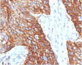IHC staining of FFPE human cervical tissue with CD9 antibody (clone CDLA9-1). HIER: boil tissue sections in pH6, 10mM citrate buffer, for 10-20 min followed by cooling at RT for 20 min.