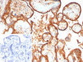 IHC staining of FFPE human placental tissue with Hexosaminidase B antibody (clone HEXB/7762). Inset: PBS used in place of primary Ab (secondary Ab negative control). HIER: boil tissue sections in pH 9 10mM Tris with 1mM EDTA for 20 min and allow to cool before testing.