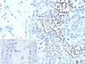 IHC staining of FFPE human testis tissue with Centrin 1 antibody (clone CETN1/9880). Inset: PBS used in place of primary Ab (secondary Ab negative control). HIER: boil tissue sections in pH 9 10mM Tris with 1mM EDTA for 20 min and allow to cool before testing.