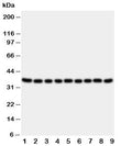 Western blot testing of Kallikrein 10 antibody and lysate from 1: rat ovary; 2: rat testis; 3: rat spleen; 4: rat liver; 5: human 22RV; 6: human SROV; 7: human HeLa; 8: human MCF-7; 9: human MM231 cells. Predicted molecular weight ~37 kDa.
