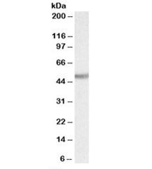 Western blot testing of rat kidney lysate with Ugt2b antibody at 0.1ug/ml. Predicted molecular weight: ~61kDa, observed here at ~50kDa.