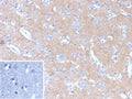 IHC staining of FFPE human brain tissue with HK1 antibody (clone HK1/9507). Inset: PBS used in place of primary Ab (secondary Ab negative control). HIER: boil tissue sections in pH 9 10mM Tris with 1mM EDTA for 20 min and allow to cool before testing.