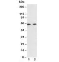 Western blot testing of p65 antibody and Lane 1: human colon cancer; 2: HeLa lysate. Expected molecular weight ~65 kDa.