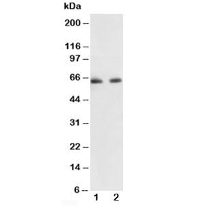 Western blot testing of p65 antibody and Lane 1: human colon cancer; 2: HeLa lysate. Expected molecular weight ~65 kDa.