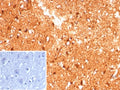 IHC staining of FFPE human brain tissue with Creatine phosphokinase BB antibody (clone CKBB/8609R). Inset: PBS used in place of primary Ab (secondary Ab negative control). HIER: boil tissue sections in pH 9 10mM Tris with 1mM EDTA for 20 min and allow to cool before testing.