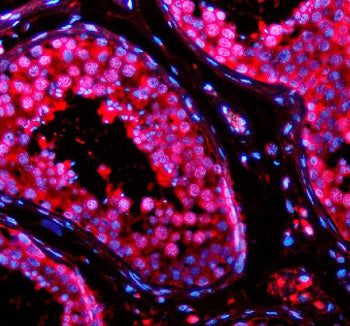Immunofluorescent staining of TSN using anti-Translin antibody (red). TSN was detected in a paraffin-embedded section of human testis tissue. Heat mediated antigen retrieval was performed in EDTA buffer (pH 8.0, epitope retrieval solution). The tissue section was blocked with 10% goat serum. The tissue section was then incubated with 5 ug/ml rabbit anti-Translin antibody overnight at 4oC. Cy3 Conjugated Goat Anti-Rabbit IgG was used as secondary antibody at 1:500 dilution and incubated for 30 min at 37oC.