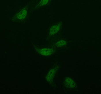 Immunofluorescent staining of ISOC2 using anti-ISOC2 antibody (green). ISOC2 was detected in an immunocytochemical section of BEAS-2B cells. Enzyme antigen retrieval was performed using IHC enzyme antigen retrieval reagent for 15 mins. The cells were blocked with 10% goat serum. And then incubated with 5 ug/ml rabbit anti-ISOC2 antibody overnight at 4oC. DyLight 488 Conjugated Goat Anti-Rabbit IgG was used as secondary antibody at 1:500 dilution and incubated for 30 min at 37oC.