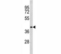 Western blot analysis of CCR3 antibody and Jurkat lysate. Visualized from 40~55 kDa