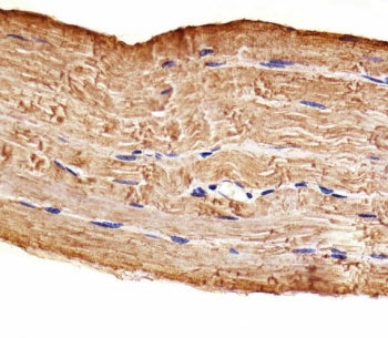 IHC testing of FFPE human skeletal muscle tissue with MAP4K3 antibody. HIER: steam section in pH6 citrate buffer for 20 min and allow to cool prior to staining.