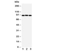 Western blot testing of ABCB6 antibody and Lane 1: HeLa; 2: MCF-7; 3: A549 cell lysate. Predicted size: 94KD.