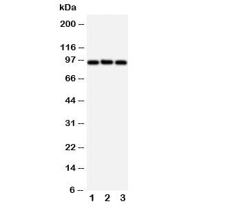 Western blot testing of ABCB6 antibody and Lane 1: HeLa; 2: MCF-7; 3: A549 cell lysate. Predicted size: 94KD.