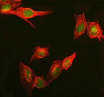 Immunofluorescent staining of FFPE human U-2 OS cells with Daxx antibody (green) and Beta Tubulin mAb (red). HIER: steam section in pH6 citrate buffer for 20 min.